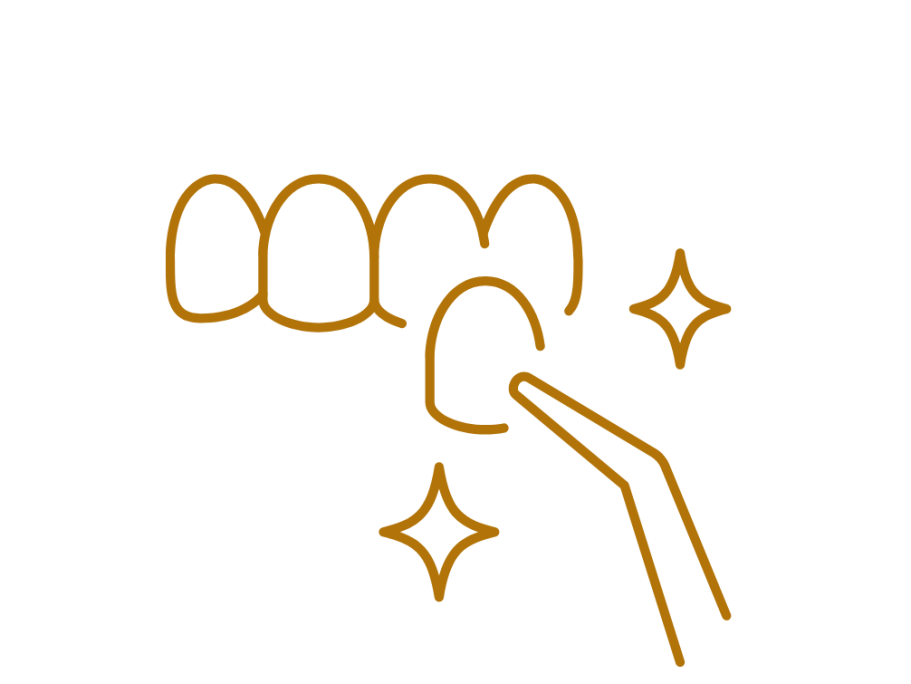 Icon Veneer-Zahnverblendung Auf einen Vorderzahn wird mit einem Instrument eine Zahn-Verblendung - Fachbegriff Veneer - aufgesetzt