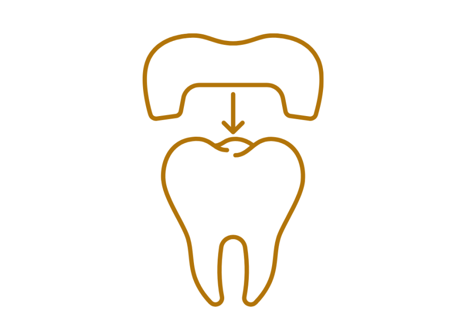 Icon Zahnfüllungen oder Schienentherapie Zahn, dem eine Krone aufgesetzt wird: symbolisiert z.B. eine Füllung