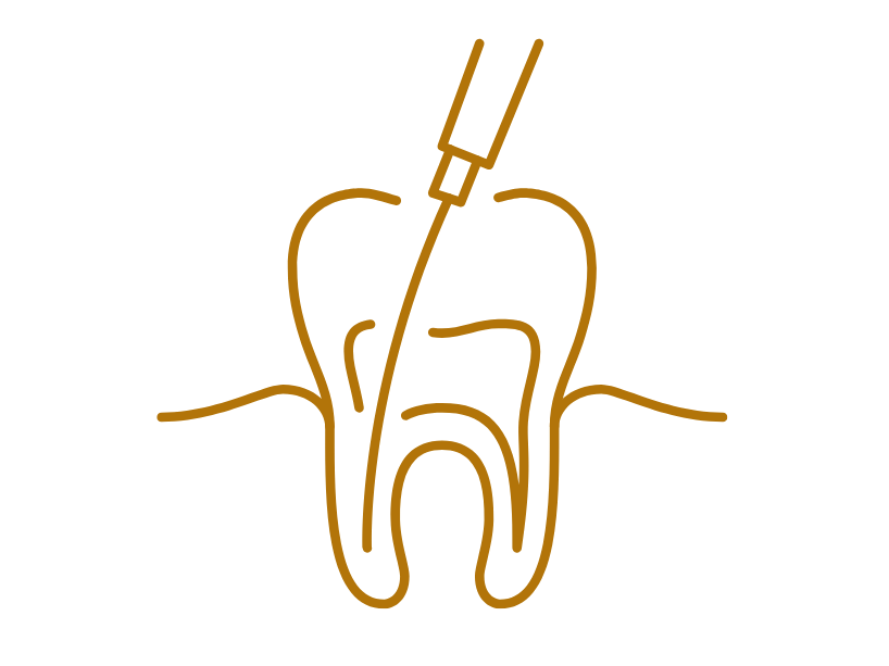 Icon Wurzelbehandlung Zahn mit einer Spritze, die eine Wurzelkanal-Behandlung anzeigt.